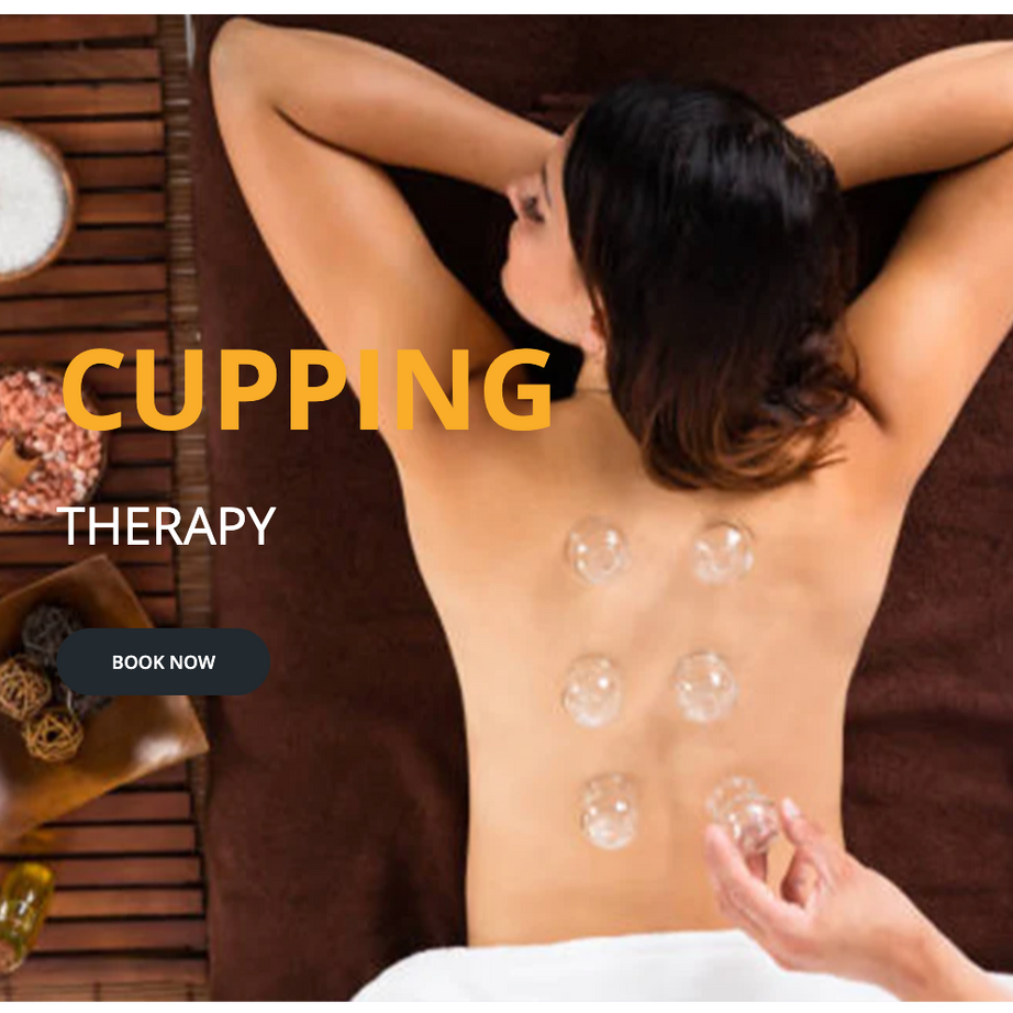 Cupping Therapy: